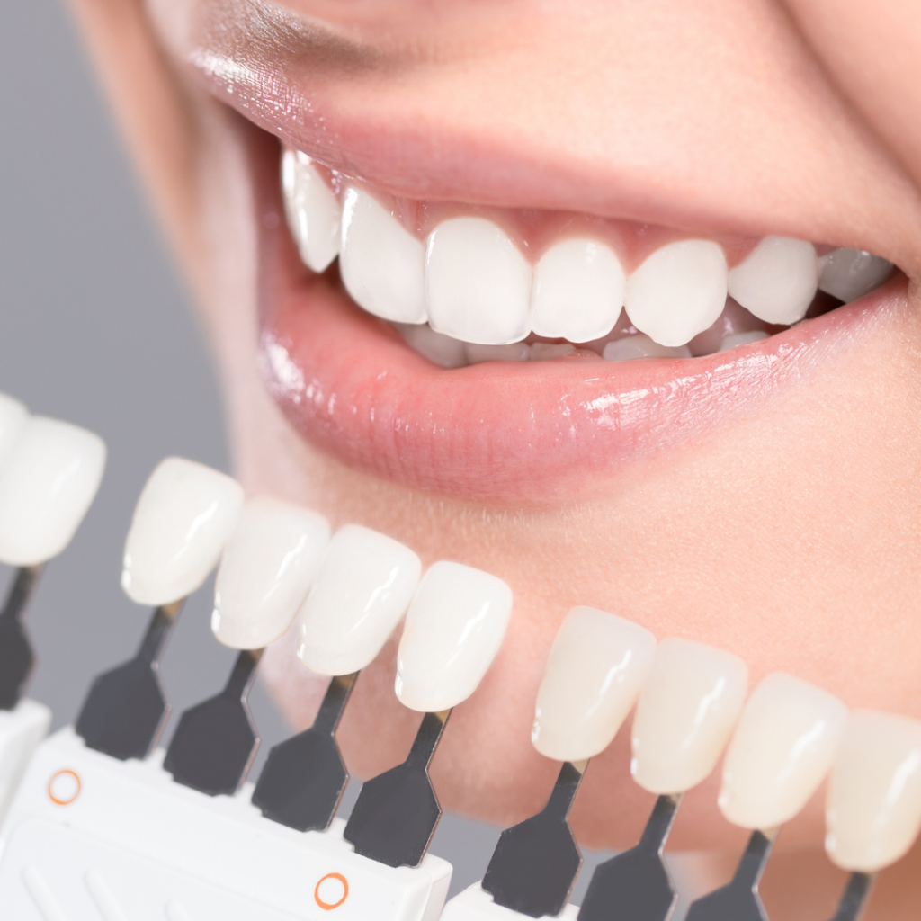 Softbleaching Kosmetik Obertraubling